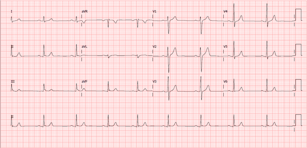 Como o Apple Watch está a mudar a saúde e o fitness 3 Como o Apple Watch está a mudar a saúde e o fitness 1